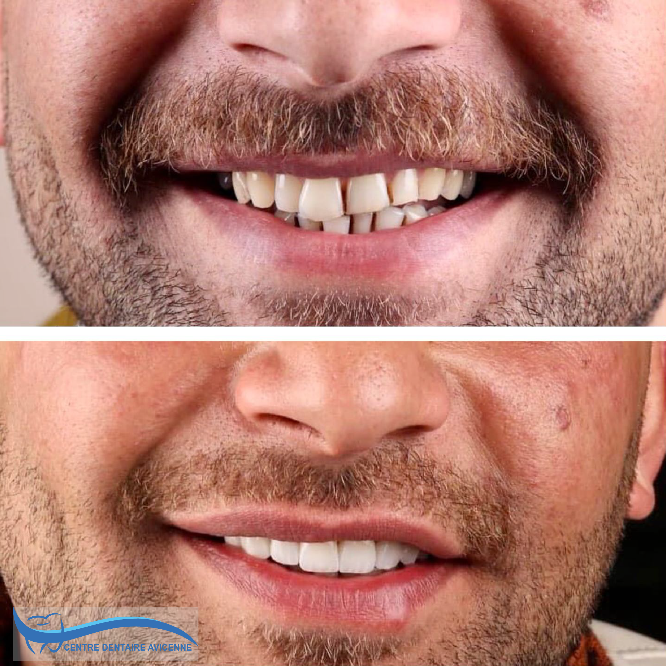 Clinic Dentaire Avicenne Clinic Dentaire Avicenne