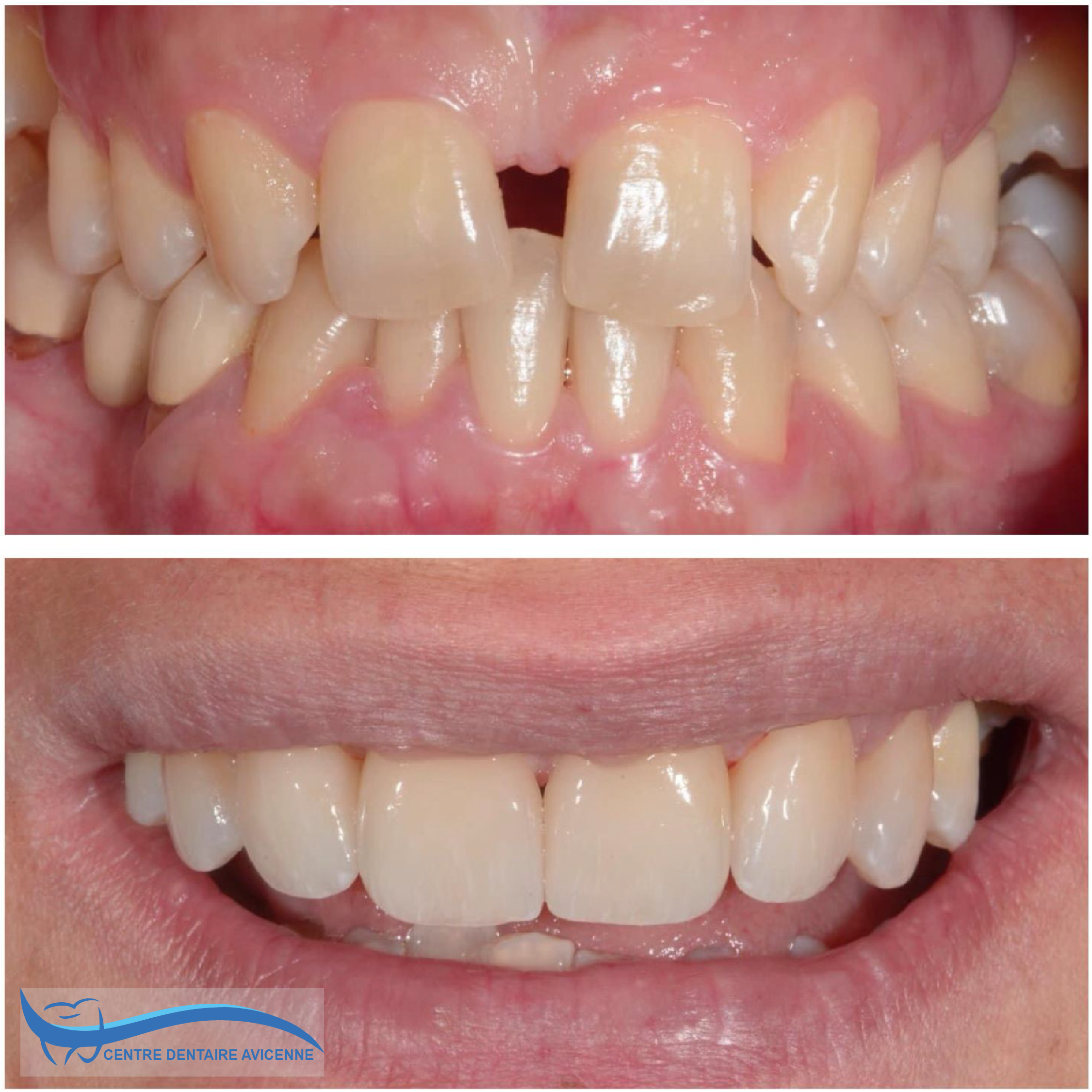 Clinic Dentaire Avicenne Clinic Dentaire Avicenne
