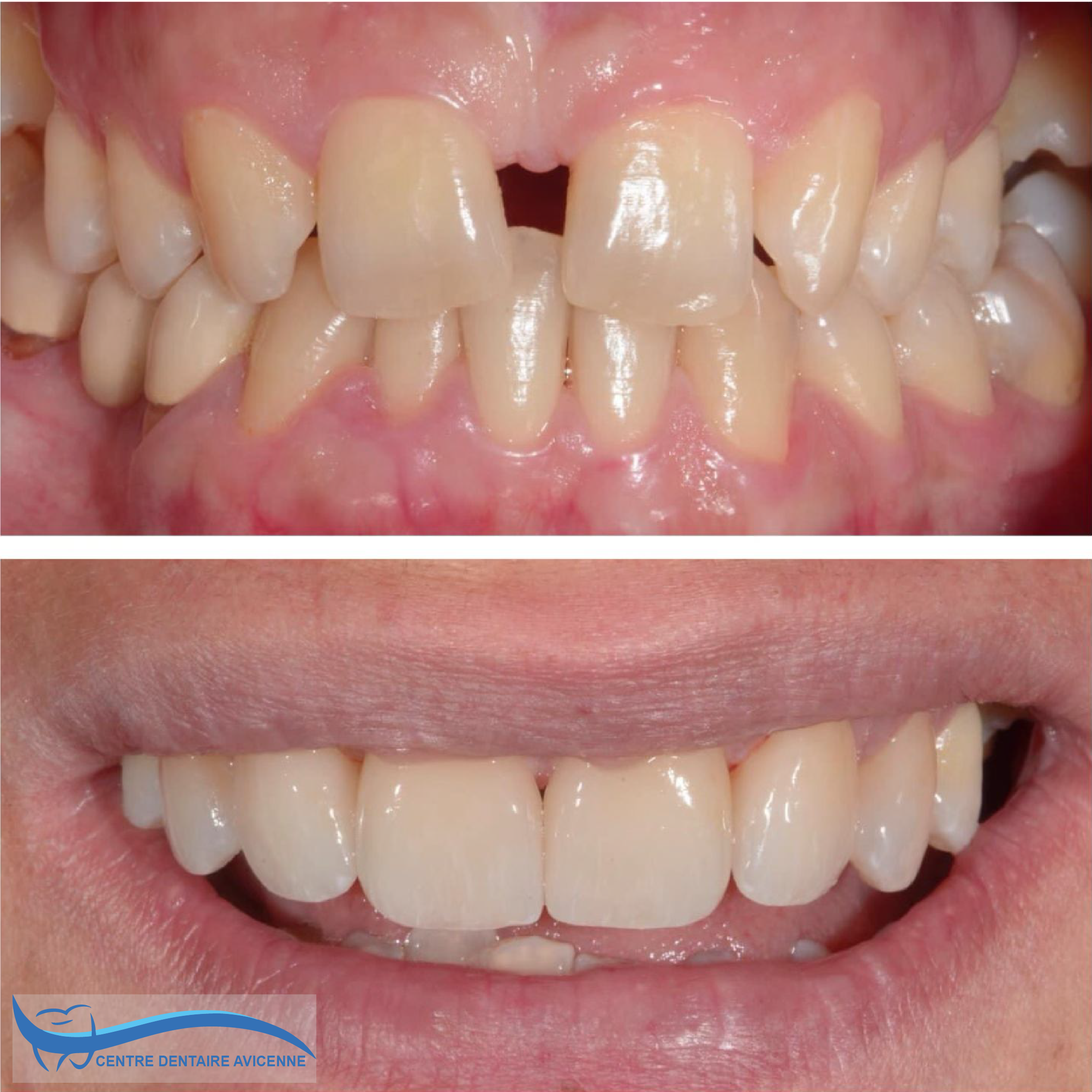 Clinic Dentaire Avicenne Clinic Dentaire Avicenne