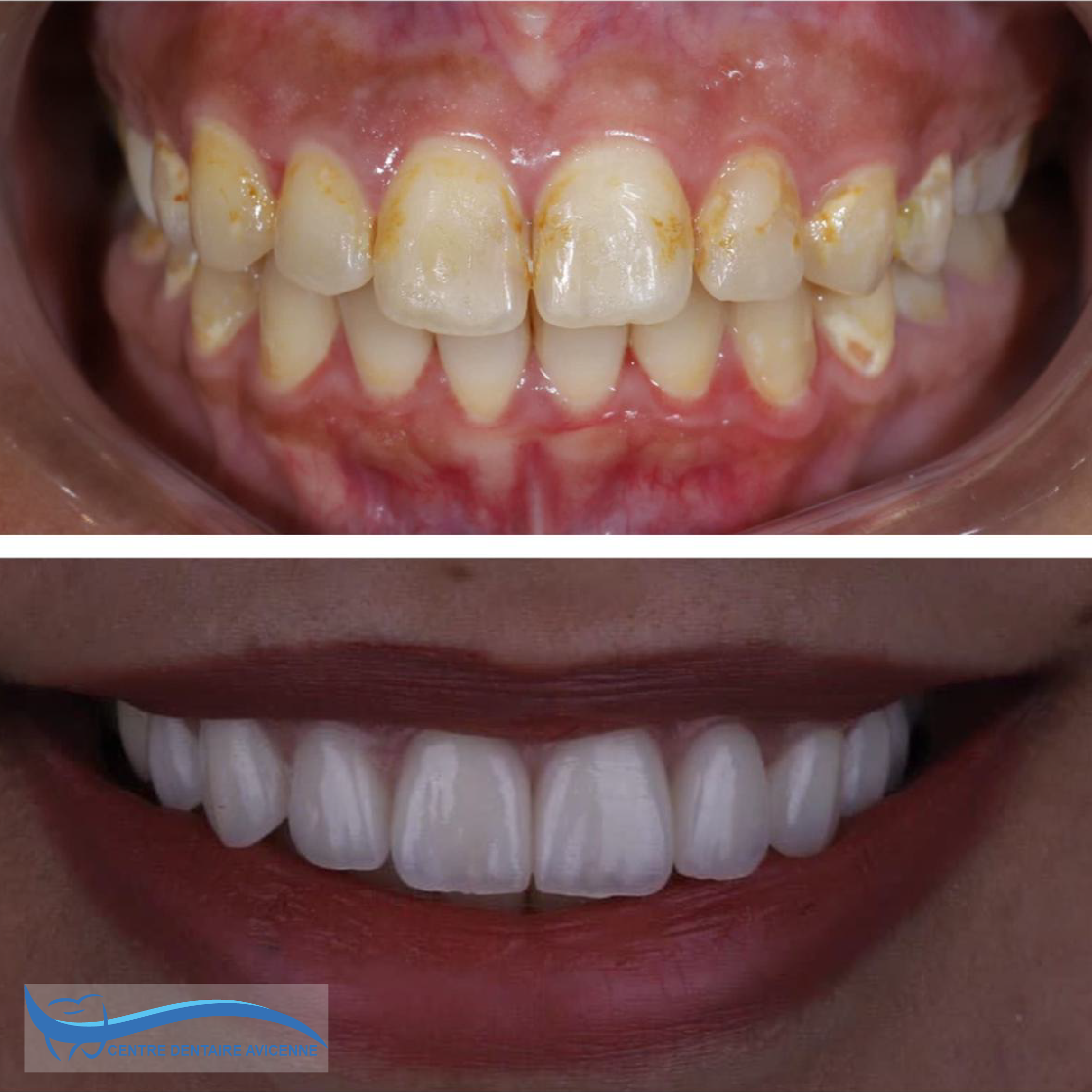 Clinic Dentaire Avicenne Clinic Dentaire Avicenne