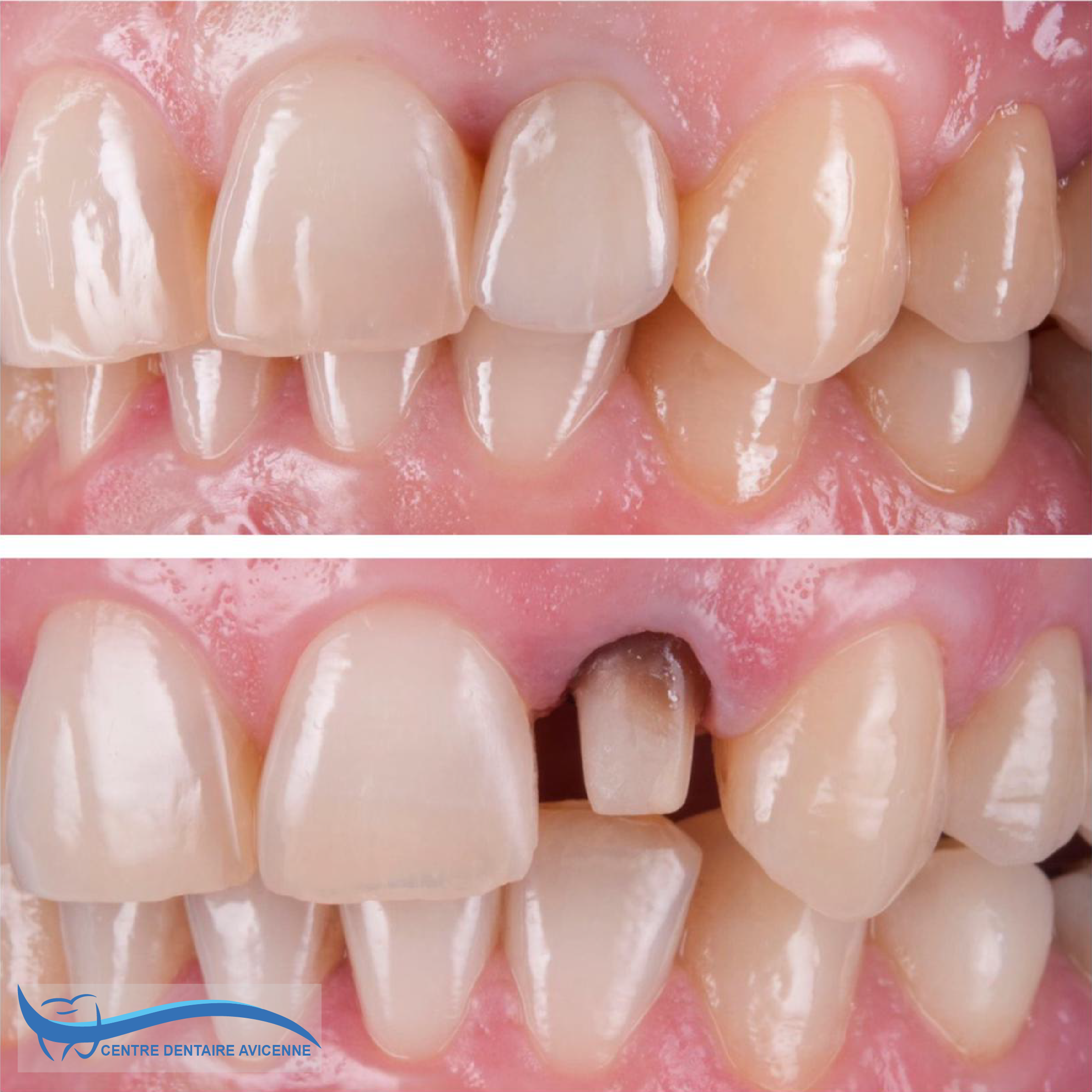 Clinic Dentaire Avicenne Clinic Dentaire Avicenne